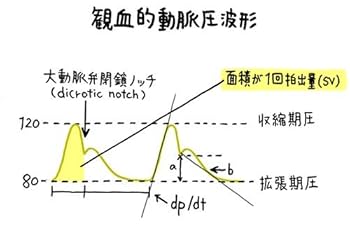 やさしくわかる! 麻酔科研修 | 讃岐美智義 |本 | 通販 | Amazon